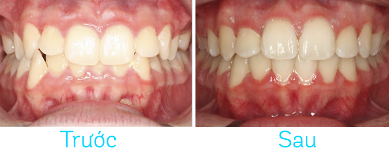 Nha khoa KDA Smile - Nha khoa uy tín quận 11