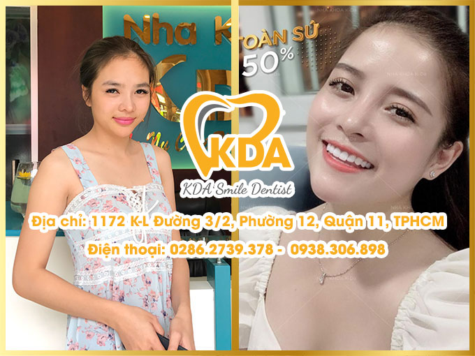 Nha Khoa KDA Smile - Địa chỉ nha khoa uy tín tại Quận 11 TPHCM